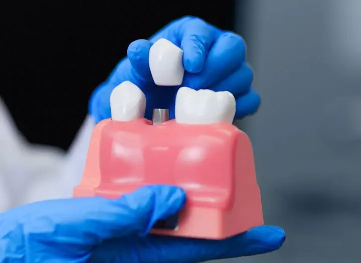 dentist removing implant on denture display